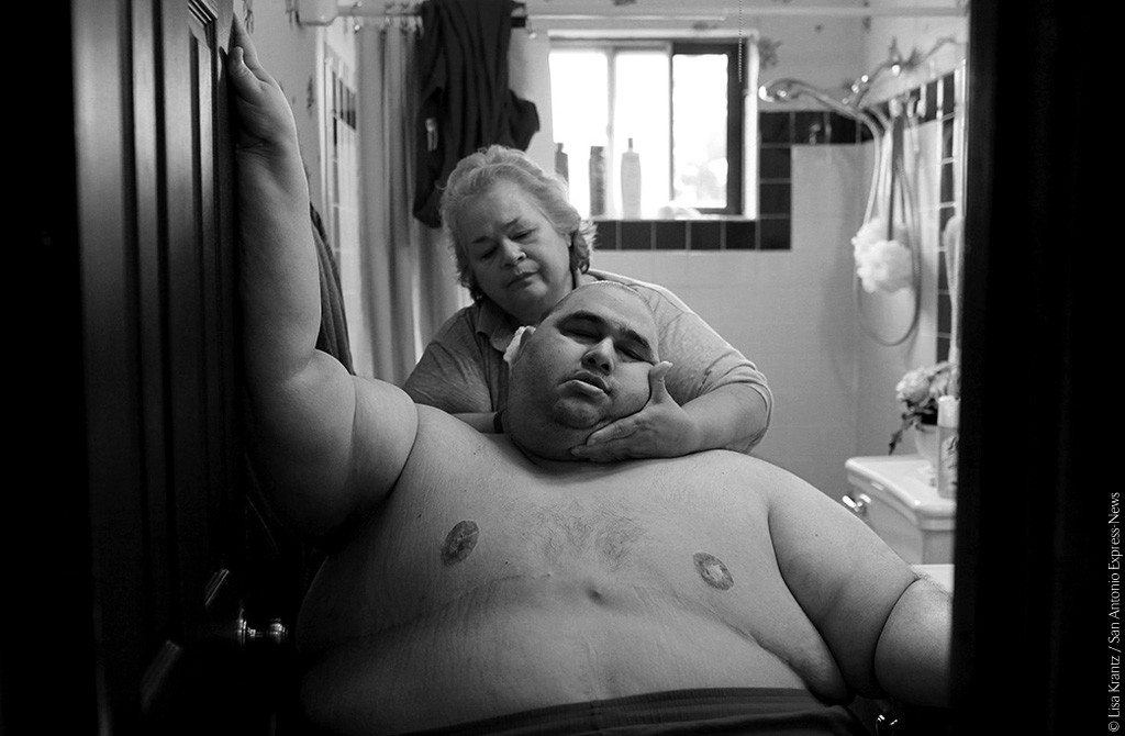 Novembre 2010. Con un peso di circa 270 Kg, Hector Garcia Jr. ha difficoltà nello svolgere normali attività quotidiane come il lavarsi. Fa fatica a camminare lungo il corridoio che porta dalla sua camera da letto al bagno, così che sua madre Elena possa lavarlo dopo avergli tagliato i capelli. Circa un mese prima Hector ha iniziato una dieta, dopo aver realizzato d’esser vicino al suo peso massimo di sempre di 289 Kg. © Lisa Krantz/San Antonio Express-News