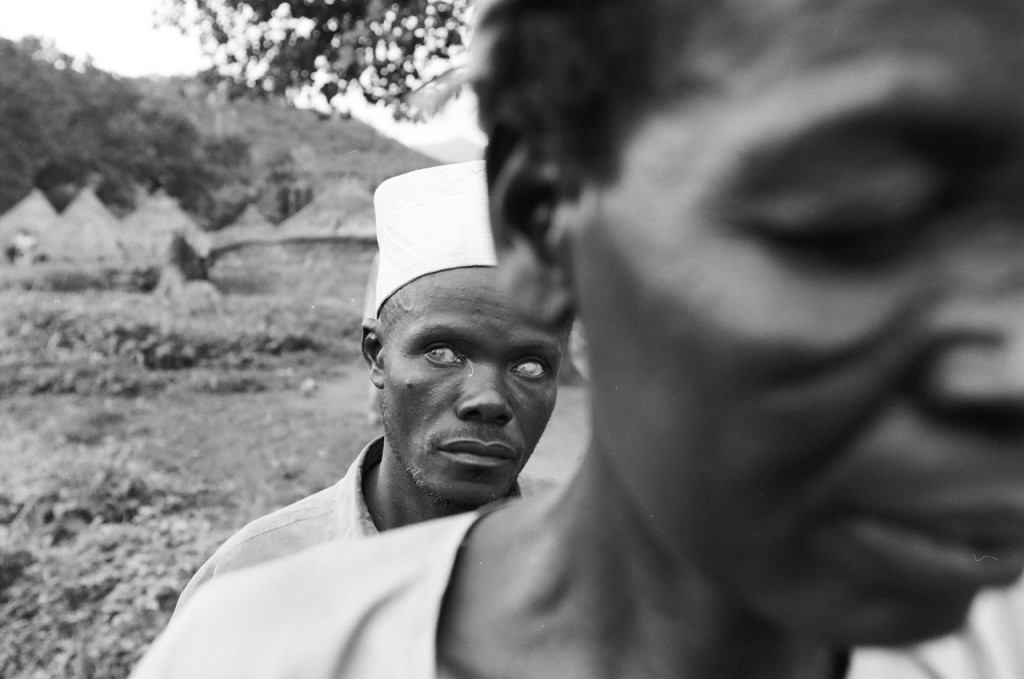 Nigeria. Cecità dei fiumi. © Luigi Baldelli/Echo Photojournalism