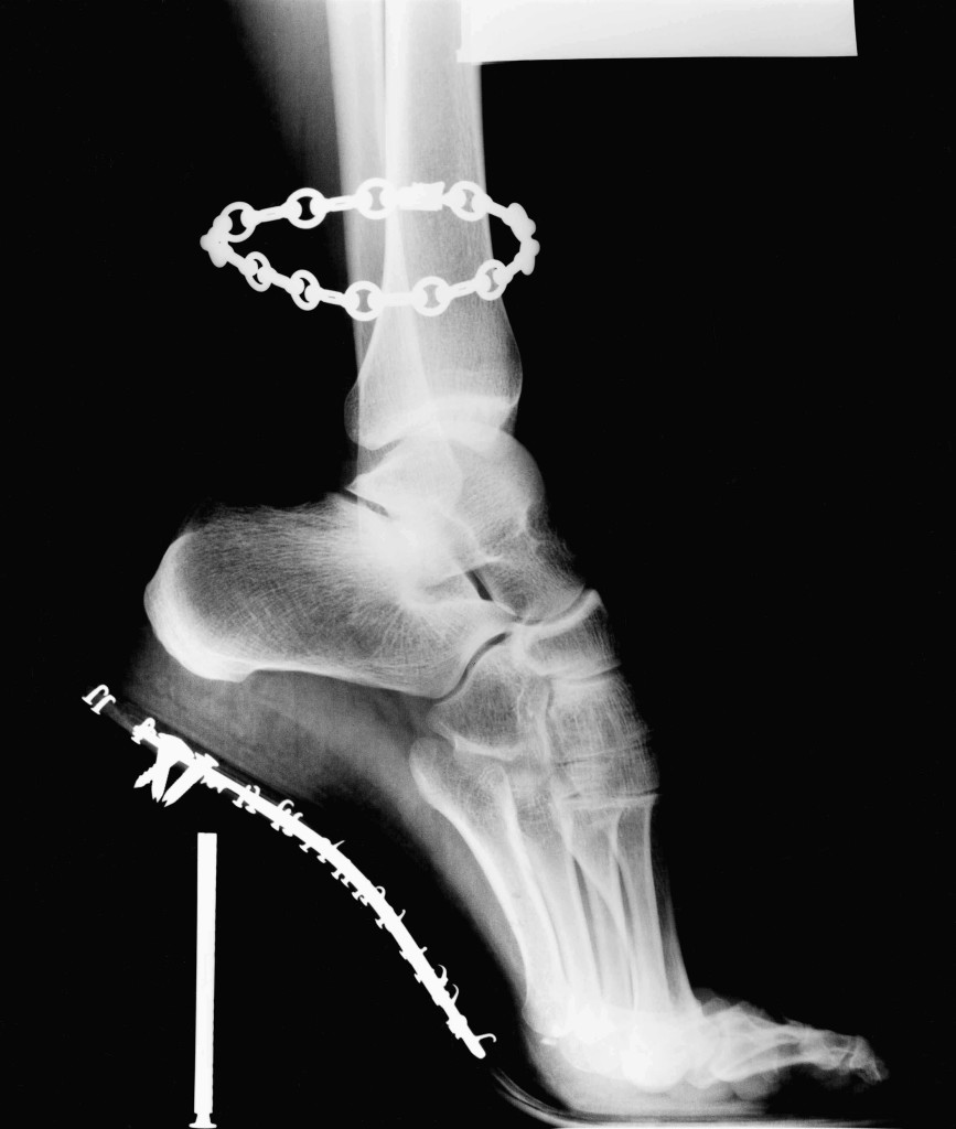 X-Ray, Van Cleef & Arpels, French Vogue, 1994 © Helmut Newton / Helmut Newton Estate 