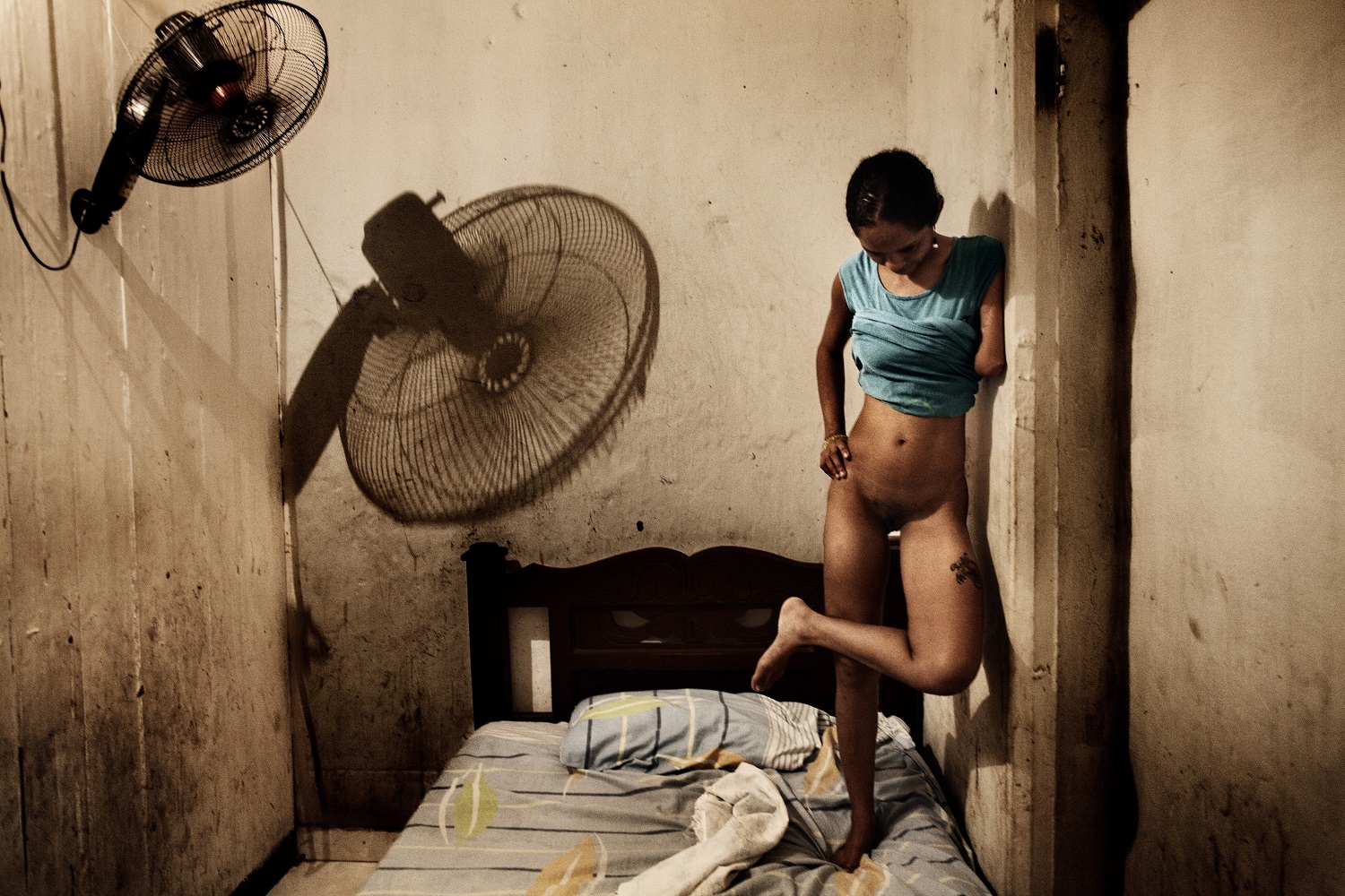 Salvador de Bahia, Brasile, 2009. Gisela è una prostituta di 21 anni a cui stato tagliato un braccio per non aver restituito un debito contratto per aver comprato il paco.